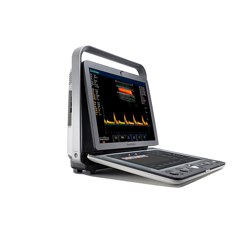 <b>AN-S9 Portable color Doppler ultrasound</b>